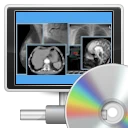 Sante DVD Burning Server